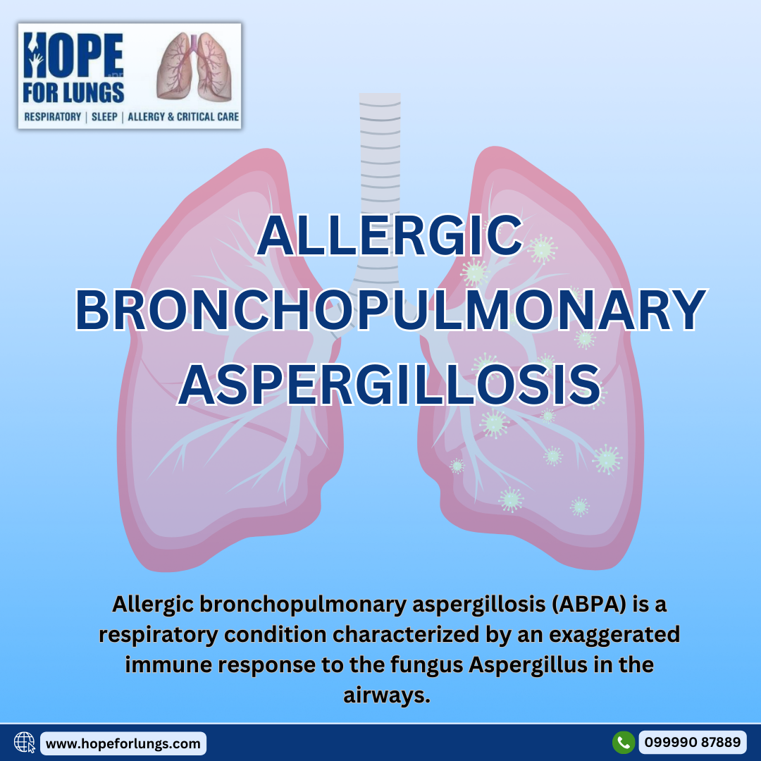 ALLERGIC BRONCHOPULMONARY ASPERGILLOSIS